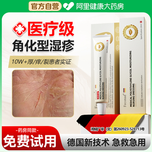 手部角化型湿疹 脱皮干裂真菌感染止痒专用非手足癣 手脚部癣膏