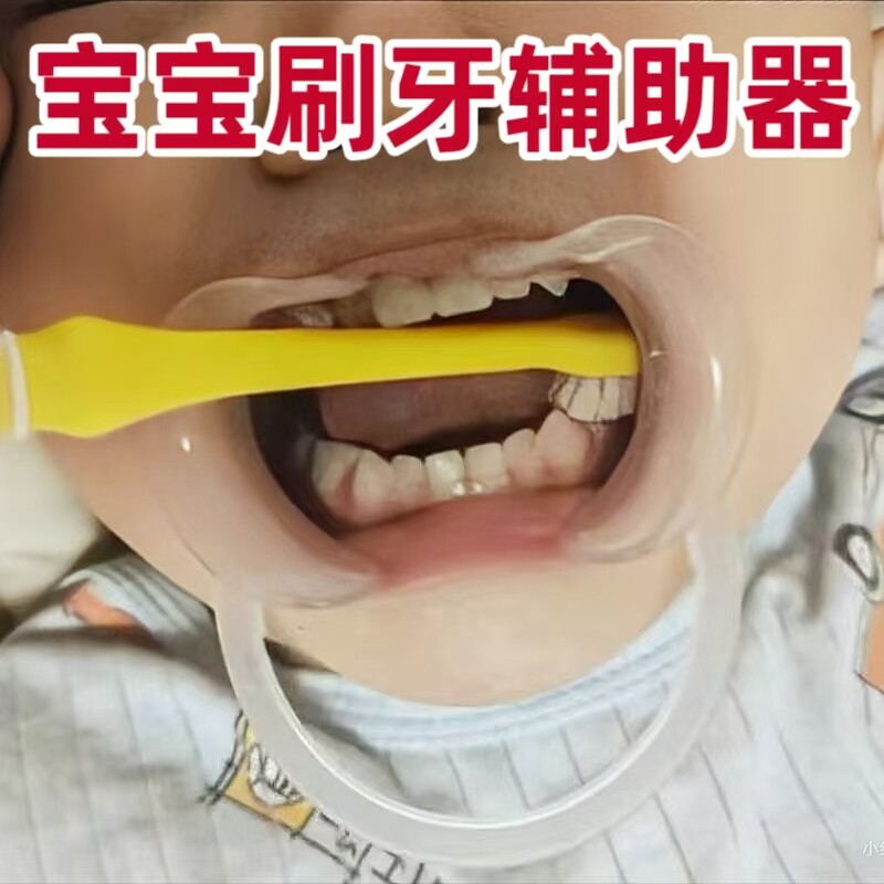 宝宝刷牙辅助器口腔清洁扩展器防咬嘴巴扩张开口儿童刷牙助手神器