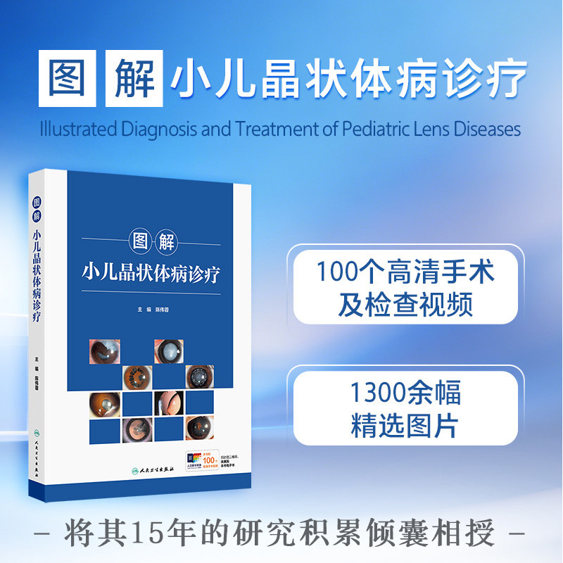 图解小儿晶状体病诊疗