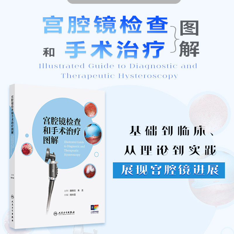 宫腔镜检查和手术治疗图解