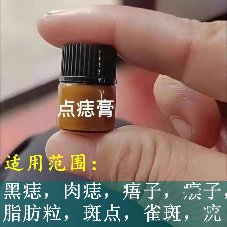 【美容院正品】点黑点黑痣肉痣凸痣痦子雀斑药水不留疤