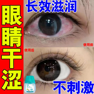 干眼症专用眼药水特效缓解眼疲劳干眼涩模糊视力不清眼睛痒滴眼液