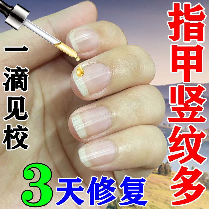 指甲有竖纹修复调理治疗甲床受损再生分离凹凸不平开裂精华营养液
