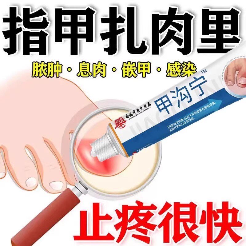 脚趾红肿热痛甲沟修护膏指甲长倒刺改善甲床软化嵌甲指甲修护乳霜