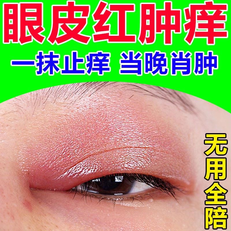 眼皮红肿痒杀菌止痒眼睛周围过敏发痒干涩板腺疏通消除散粒肿眼膏