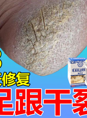 脚干裂脱皮苗家药膏手脚专治干裂真菌感染脚后跟开裂烂脚丫的药