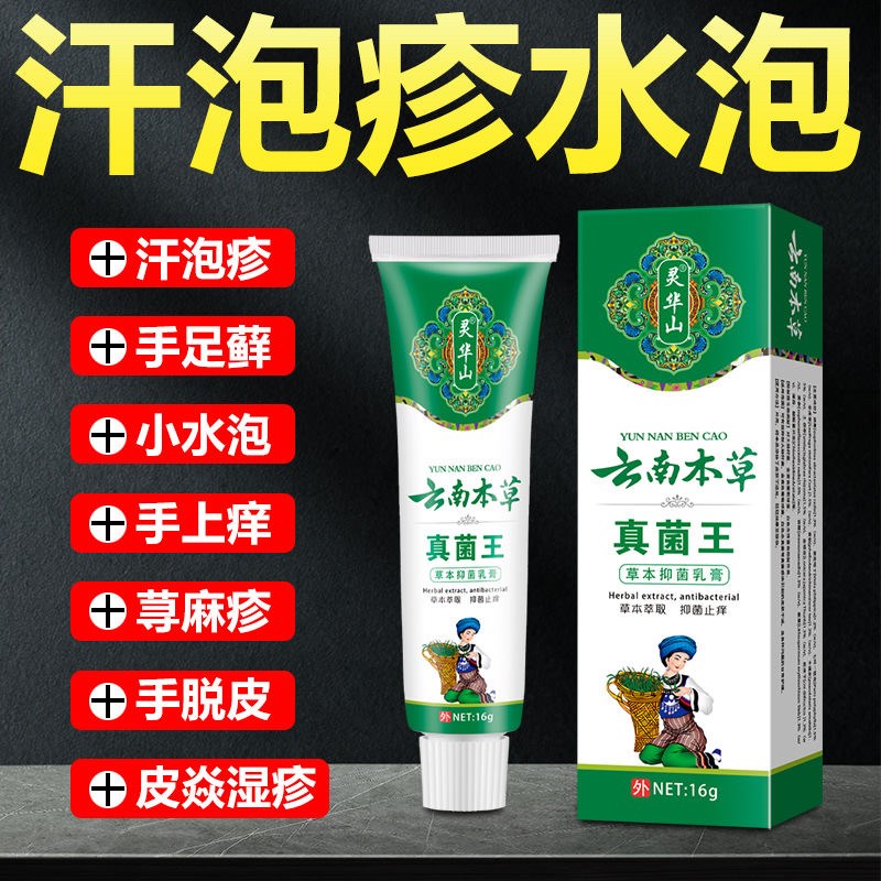云南真菌王汗疱疹手上起小水泡手痒脱皮干裂手足癣真菌感染鹅掌风
