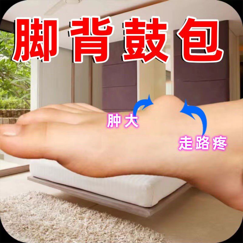 脚背鼓包筋膜焱酸痛肿胀脚踝脚面后跟疼扭拉伤麻木腱鞘肿止疼膏