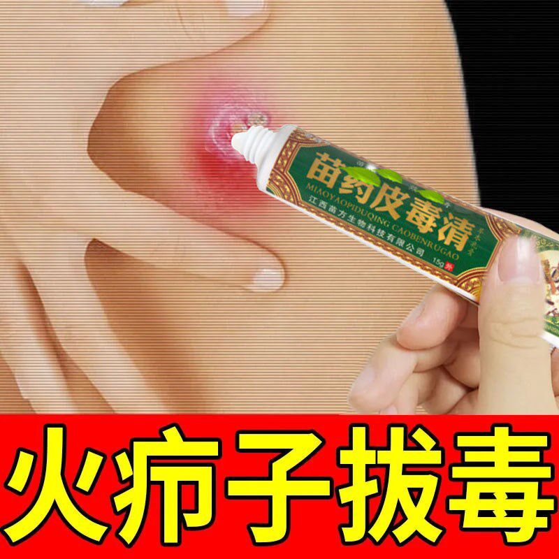 火疖子拔毒膏拔脓膏 拔毒软膏 头皮毛囊祛痘 屁股坐板疮 肛周专用