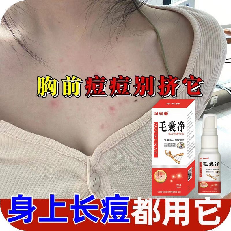 【背痘买他】后背祛痘喷雾祛痘印去前胸脖子男女背部长痘美背除螨