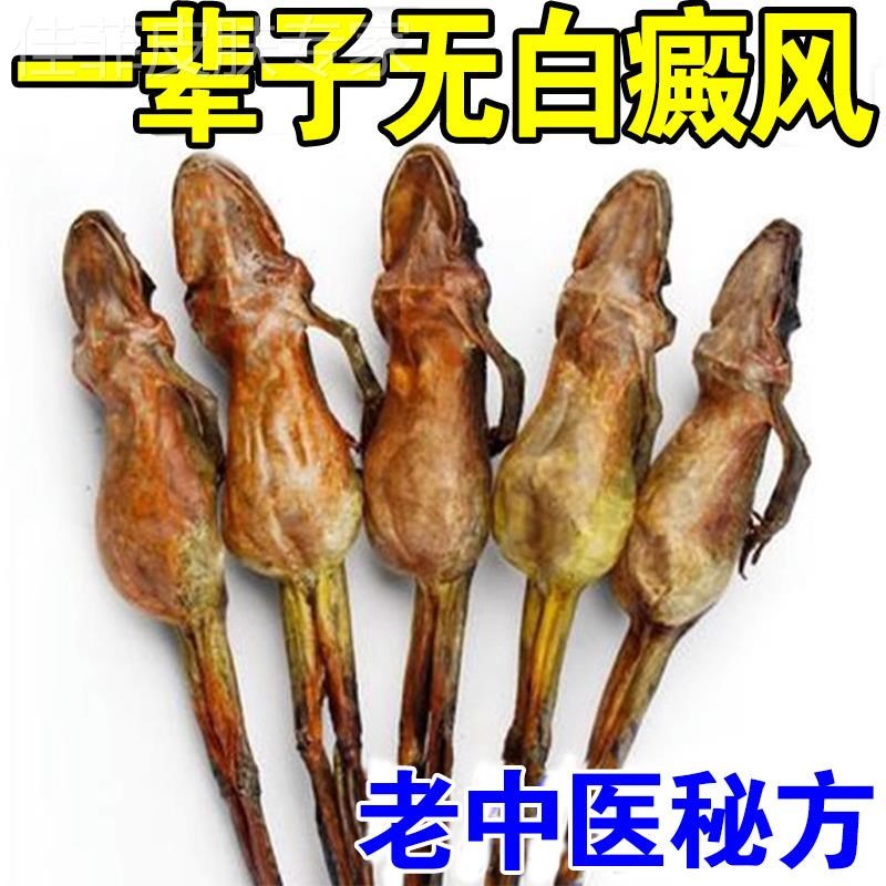 【祖传百年】癜风膏去白斑黑色素白癜风防白斑净白癜风膏Y