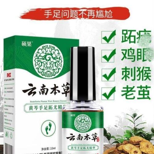 硕果云南本草黄芩手足趾尤精华液手足尤去跖尤净膏鸡眼膏贴肉刺猴