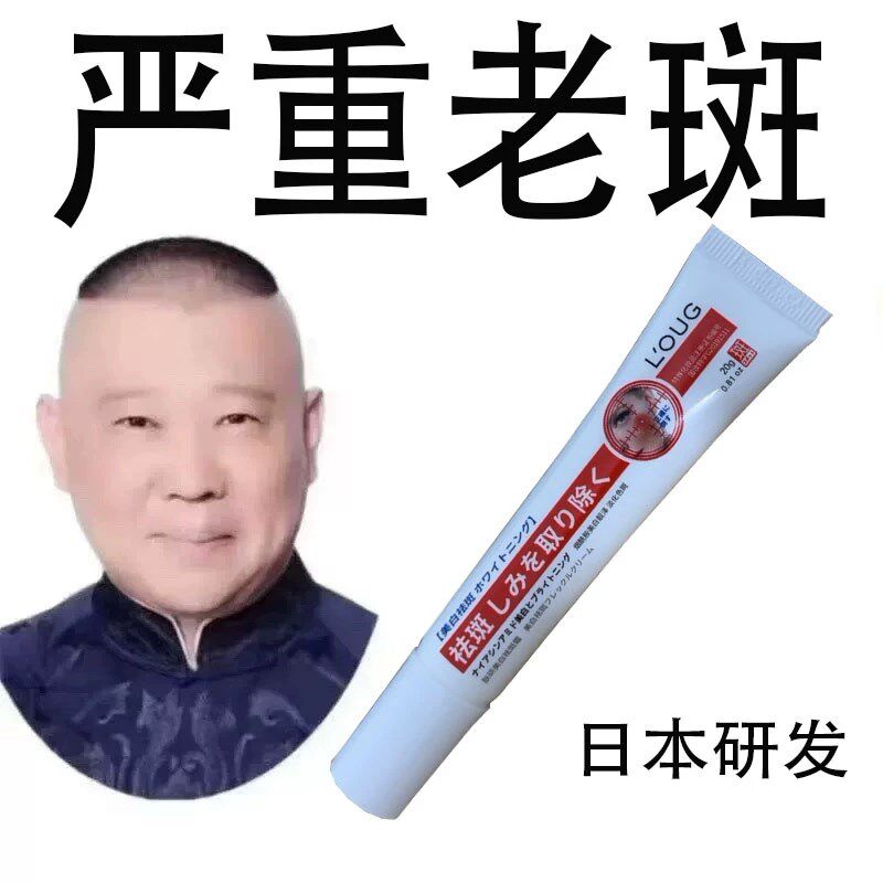 去斑霜去老年斑黑色素斑点脸部去手上手部手背的药膏强力去除正品