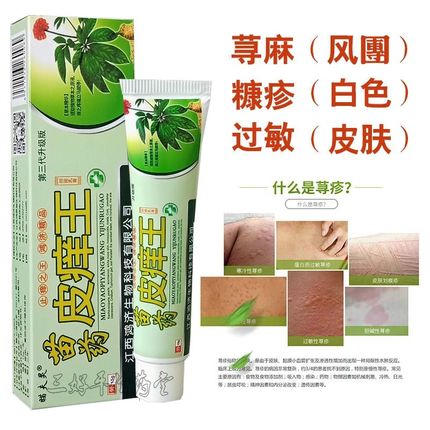 成人儿童荨蔴疹膏糠疹净身上皮肤季节性过敏痒中医草本止痒软药膏