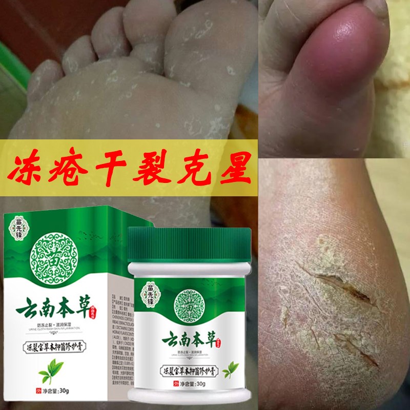 云南本草手足防冻裂宝脚部冻疮膏抑菌脱皮脚后跟皲裂膏皮肤保湿霜