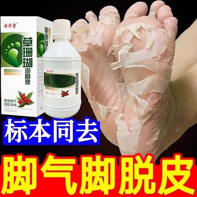 脚气泡脚药水去死皮老茧止痒脱皮杀菌水泡香港烂脚丫真菌脚气泡脚
