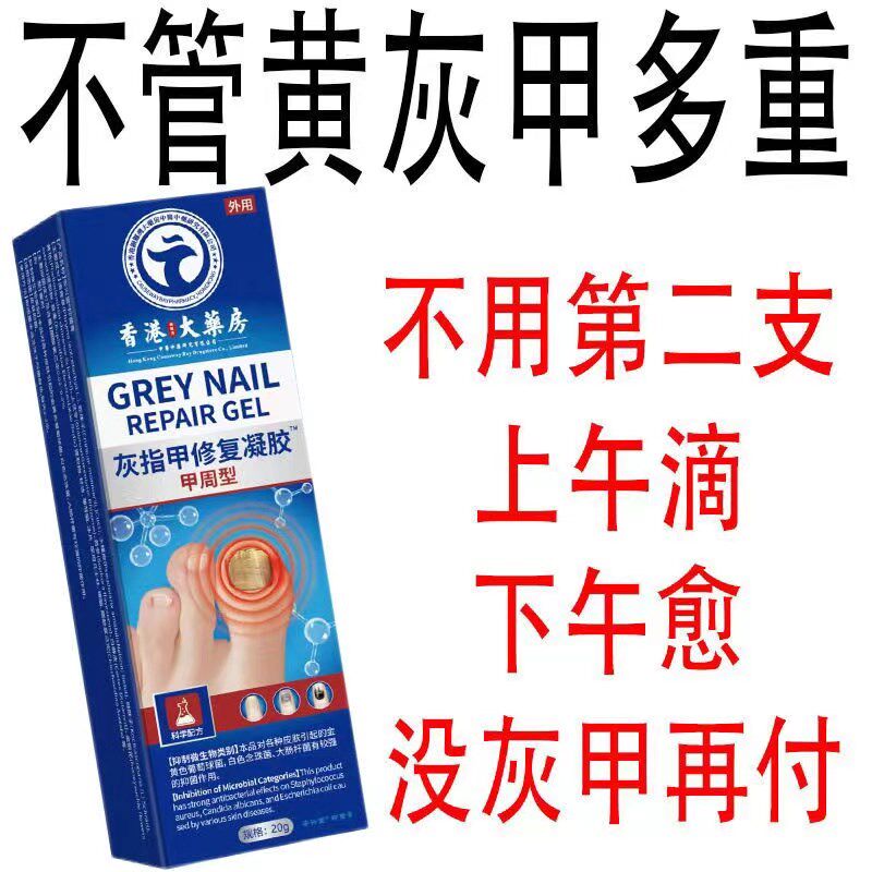 正品快速亮甲脚趾真菌感染甲沟炎变色灰指甲增厚坏甲专用抑菌乳膏