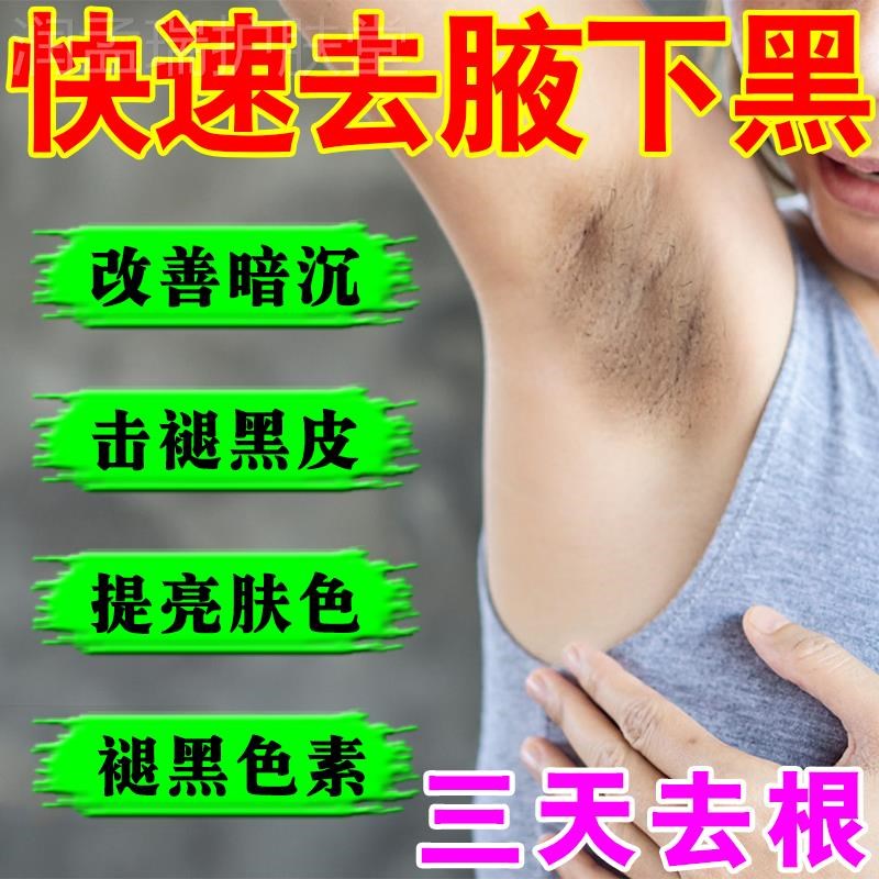 关节腋下去黑神器去黑色素沉淀手肘膝盖按摩膏全身屁股黑坐印去除