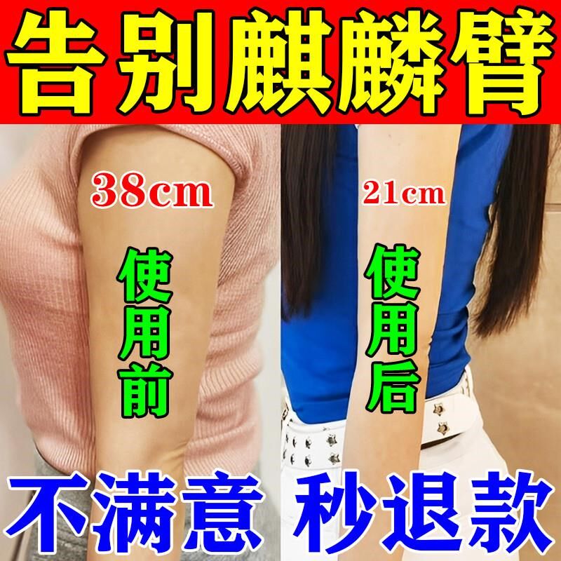 快速去手臂神器大粗胳膊蝴蝶臂减拜拜肉告别麒麟臂神器女神燃脂贴