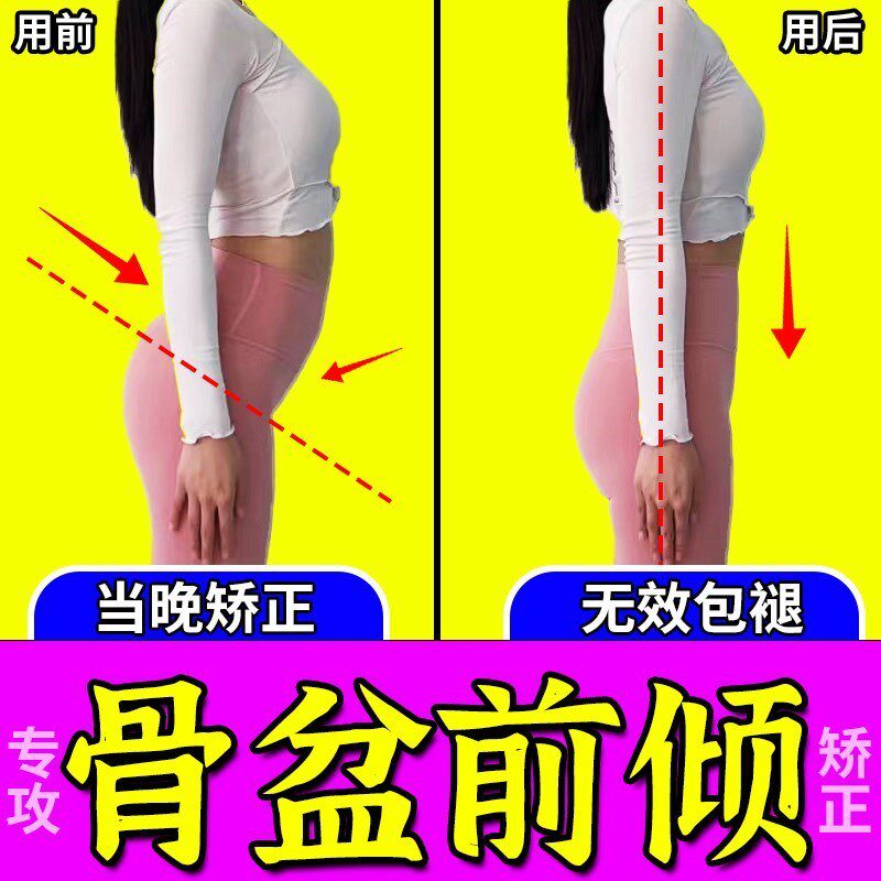 骨盆前倾矫正器收缩盆骨小腹突出假胯宽专用修覆收胯神器女正胯贴