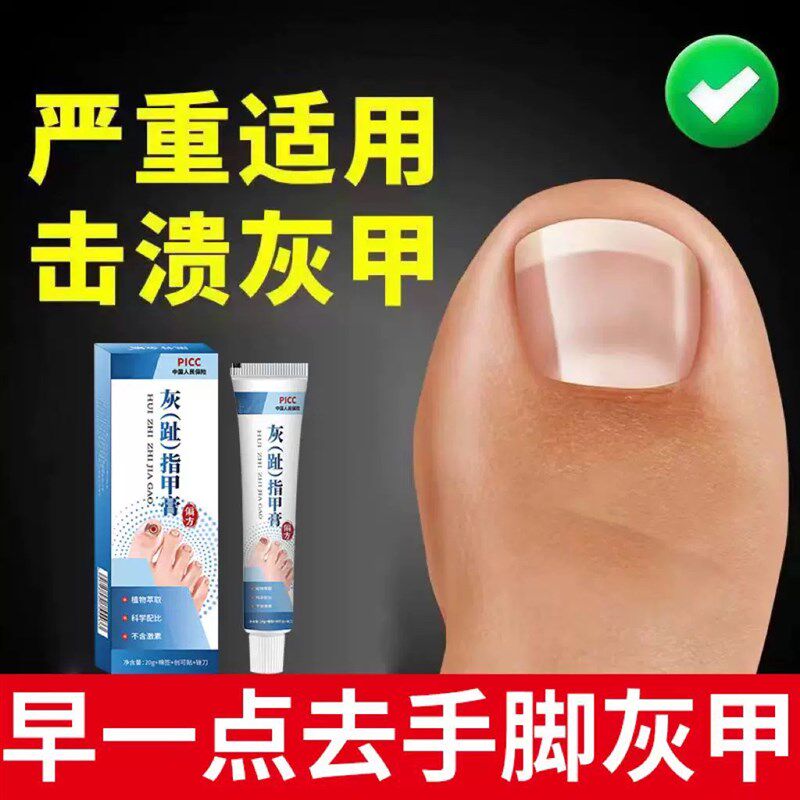 正品快速趾甲脚趾真菌感染甲沟炎变色灰指甲增厚修复草本无痛亮甲