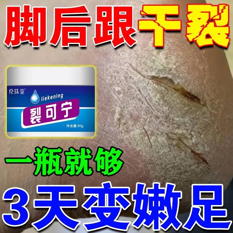 专冶脚裂脚后跟干裂起硬皮足跟开裂真菌防感染治皲裂脱皮修复霜膏