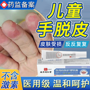 手指脱皮指尖专用儿童手癣膏脱皮干裂真菌感染严重蜕皮干燥起皮oa