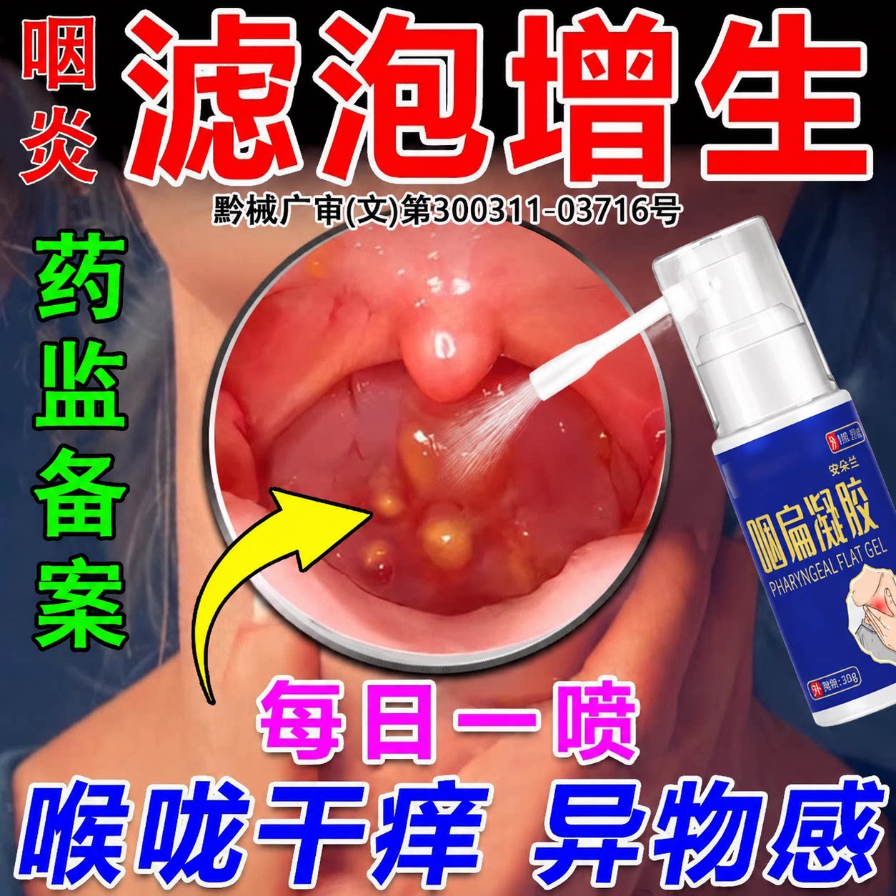 咽喉炎滤泡增生医用喷剂