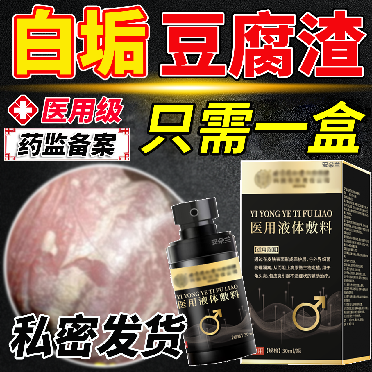 龟头炎症专用包皮炎皮豆腐渣白垢红肿水泡下面真菌感染瘙痒异味H