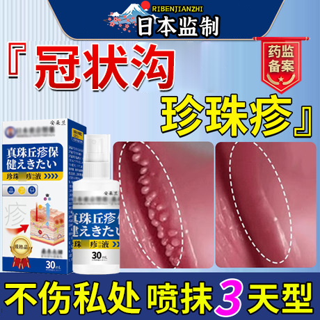 日本冠状沟珍珠丘疹专用喷剂