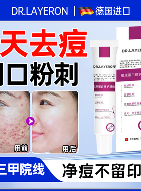 祛痘印修复淡化痘印青春痘去痘膏祛痘去闭口粉刺男女学生专用正品