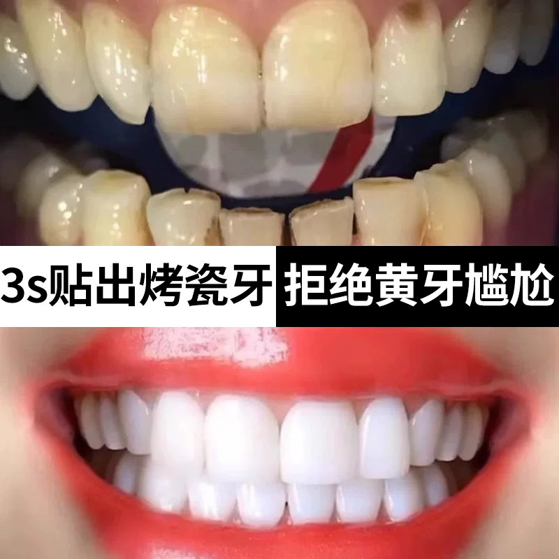377美白牙贴牙齿强效去黄洁白牙贴片变白清洁烟渍牙黄牙垢神器