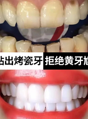 法国美牙白贴牙齿去黄洁白变白清洁牙白神器速效美片膜牙黄旗舰店