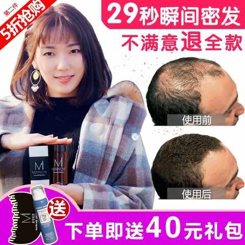 发际线神器填充发髻物理密发假发头发变密增发纤维粉快速补发密发