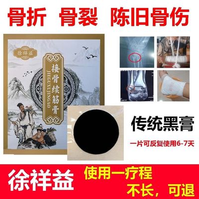徐祥益骨折接骨膏骨裂恢
