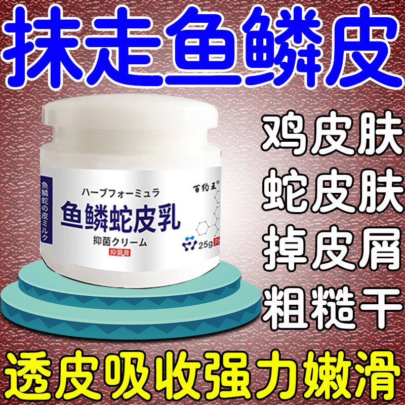 抹走鱼鳞皮】全身四肢鱼鳞皮肤鸡皮肤干燥粗糙掉屑瘙痒身体乳液霜