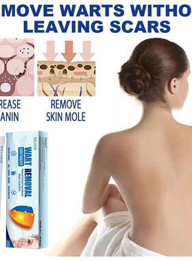 EELHOE 祛尤膏 清洁皮肤修护护理身体脸部去除脸部标签克尤膏
