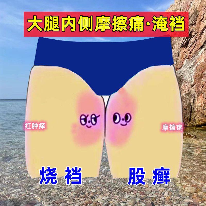 大腿内侧摩擦痛【烧裆】红肿股藓大腿根部淹红潮湿腹沟股破皮潮红