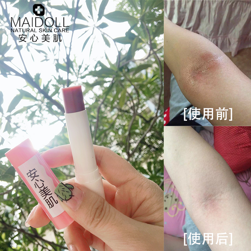 安心紫草膏婴儿成人驱蚊红屁股奶蘚抑菌止痒舒缓清凉宝宝万用膏