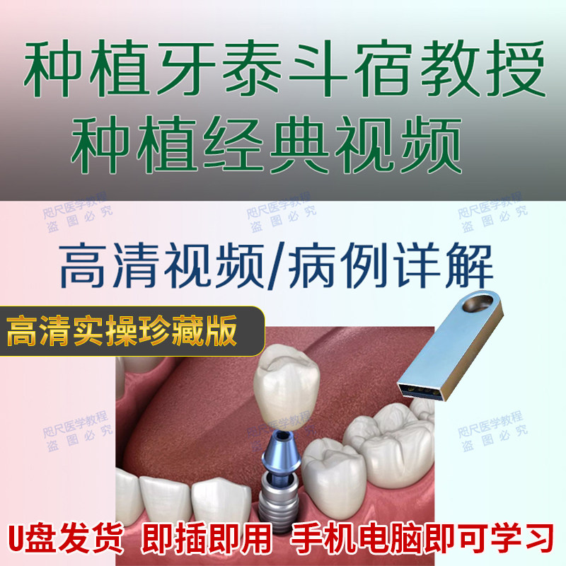 U盘种植牙视频上颌窦底提升上下颌牙齿整形修补缺损重建口腔诊疗