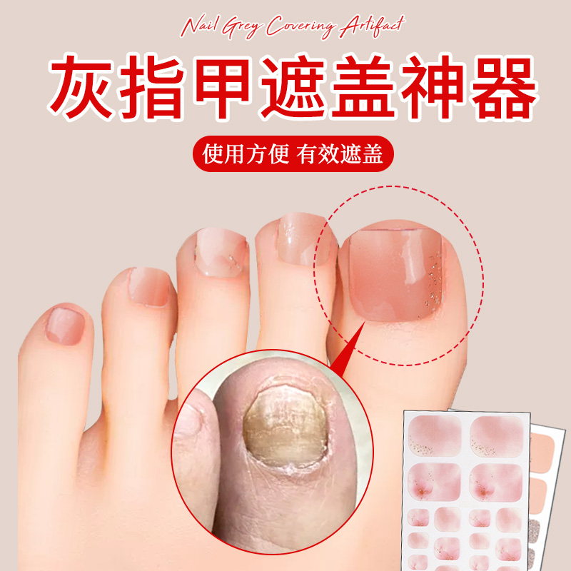 灰指甲遮盖神器灰指甲脚趾遮盖美观遇水不掉贴合牢固遮盖脚趾贴