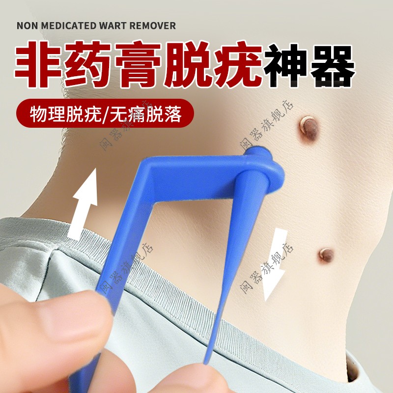 非药膏脱疣神器瘊小肉粒疙瘩脖子长祛丝状疣皮赘球立净物理工具