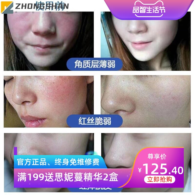 激素脸修护精华液快速退红修护屏障精华液喷雾晒后术后泛红修复液
