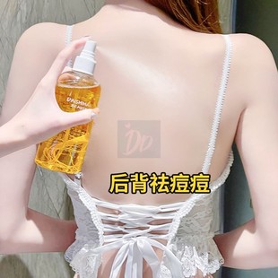 背上长痘痘后背前胸祛痘除螨止痒喷雾身体补水去痘印粉刺清爽控油