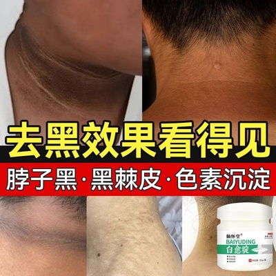 脖子黑黑的黑棘皮症屁股腋下大腿内侧去黑色素药膏神器洗不净儿童