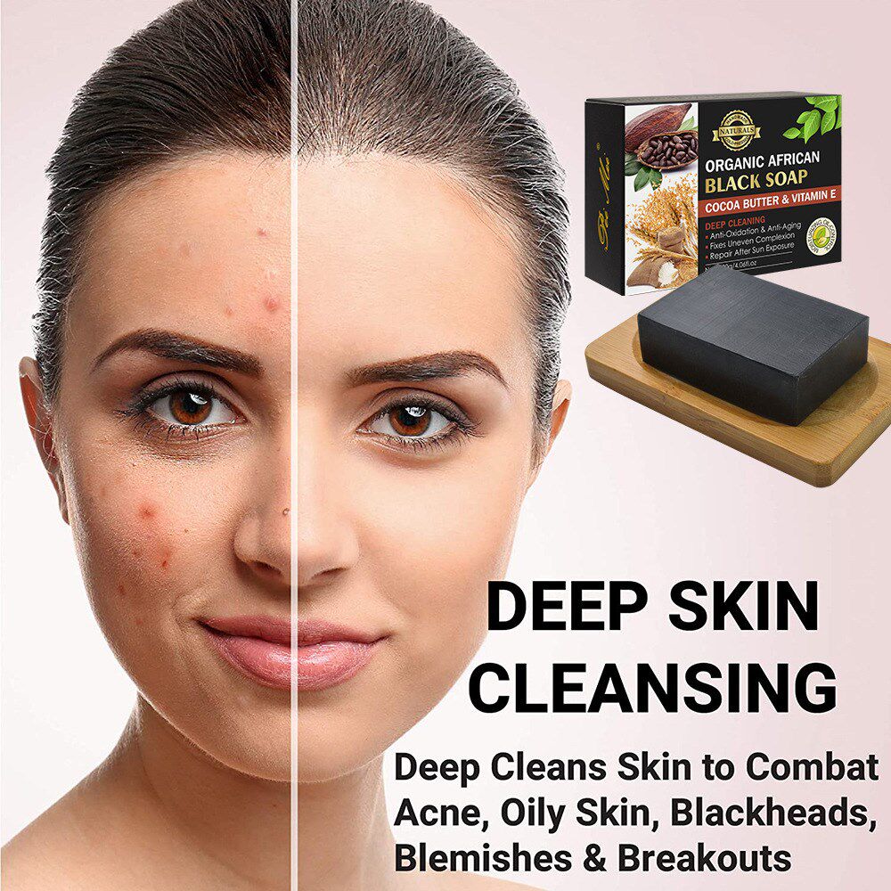 3 pcsorganic african black soap oil acne skin blackhead blem