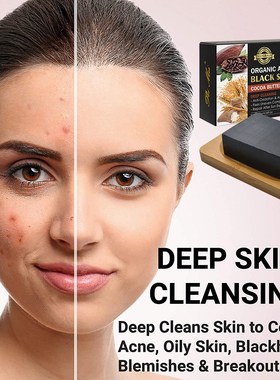 3 pcsorganic african black soap oil acne skin blackhead blem