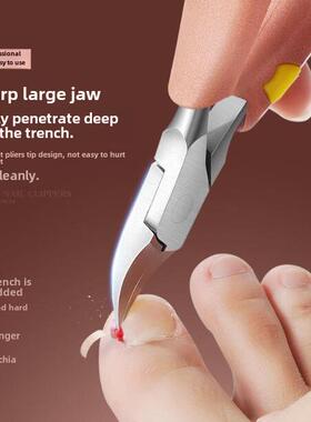 foot hand dedicated ingrown toenail in embedded a pedicure