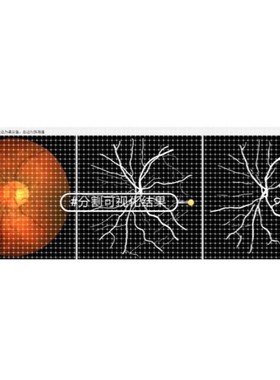 Python医学图像分割(眼底血管分割)