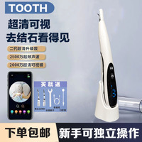 德国可视超声波洁牙器洗牙齿污垢除牙结石家用电动洁牙仪冲牙器